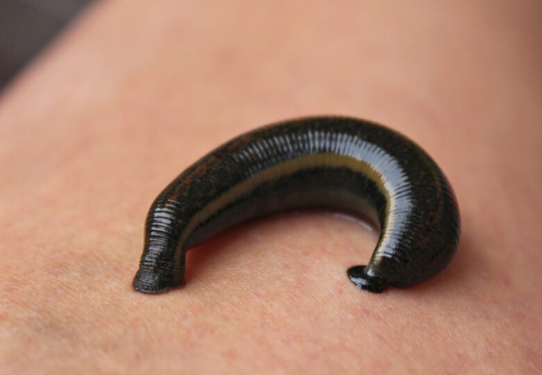 Leeches for skin fungus – can leeches cure fungal infections?