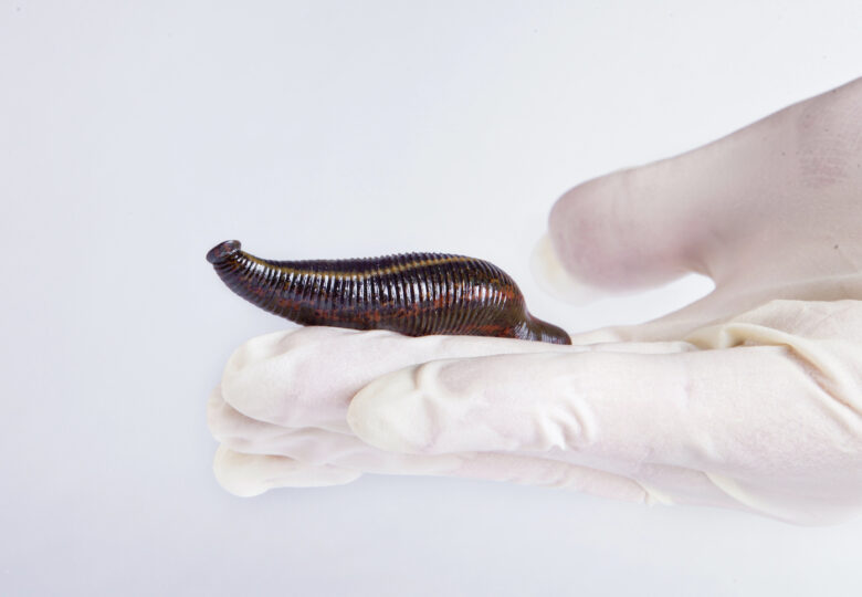 Leeches for rheumatic diseases. How can leech therapy help with joint pain?