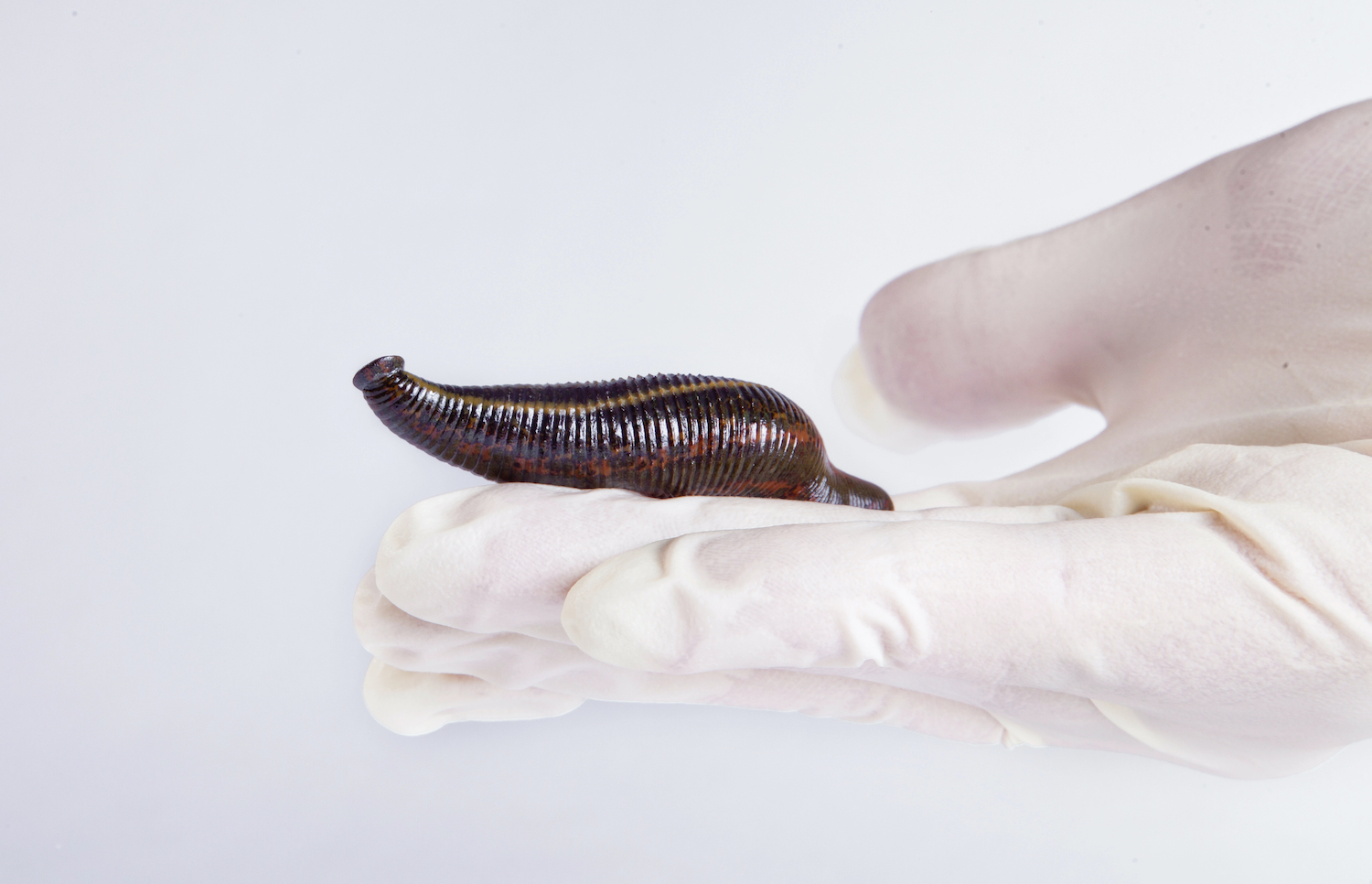 Leeches for rheumatic diseases. How can leech therapy help with joint pain?