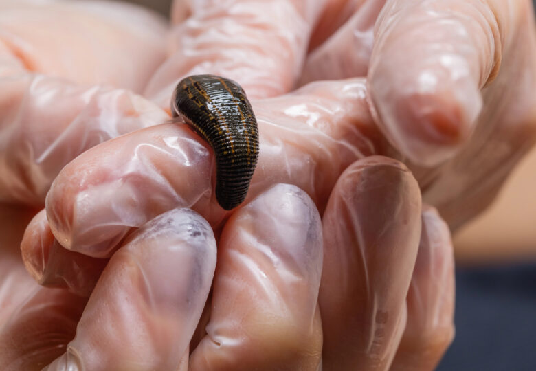 Leeches and diabetes – do leeches alleviate diabetes symptoms?